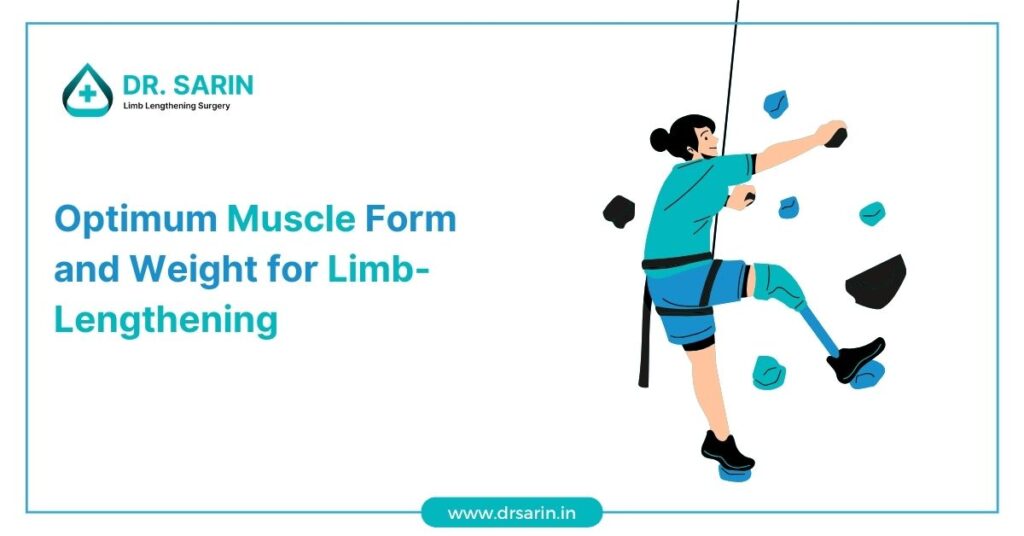 Weight For Limb-Lengthening