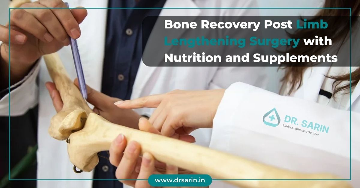 Bone Recovery Post Limb Lengthening Surgery with Nutrition and Supplements