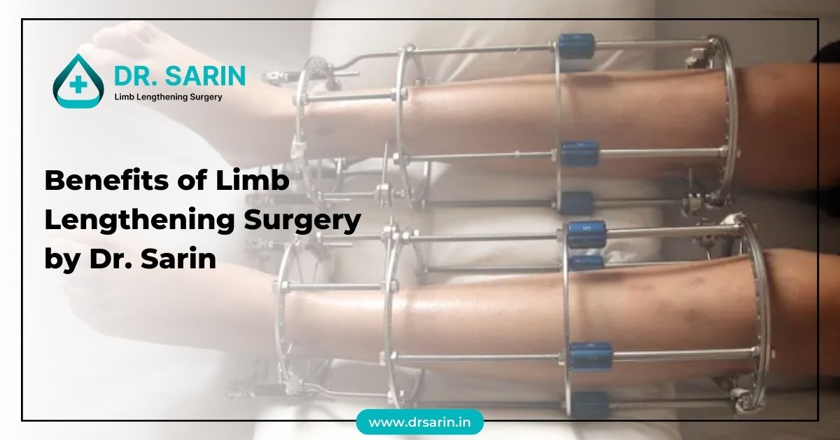 Benefits of Limb Lengthening Surgery
