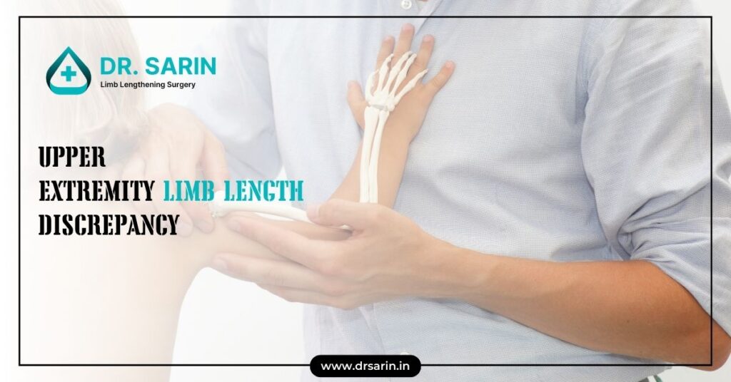 Difference in Upper Extremity Limb Length