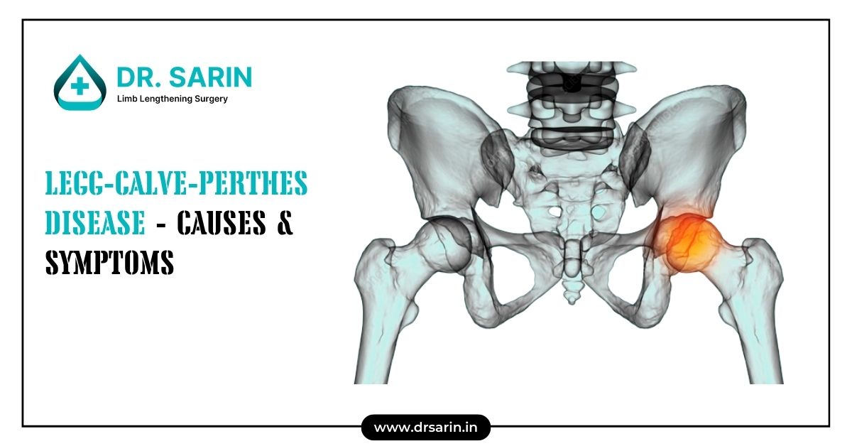 Legg-Calve-Perthes disease