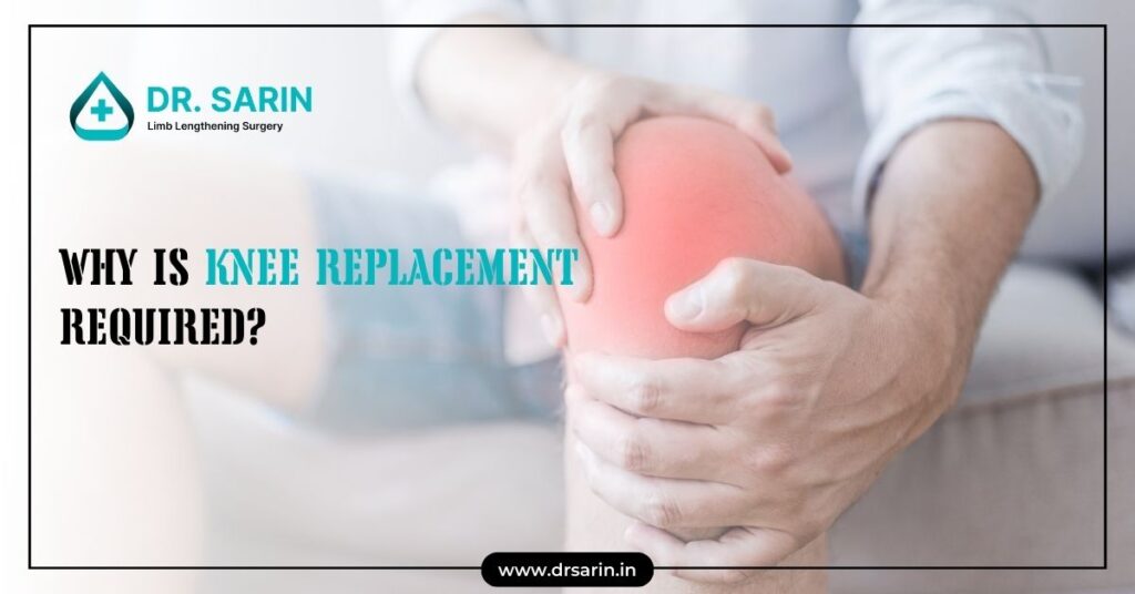 Why is Knee Replacement Required