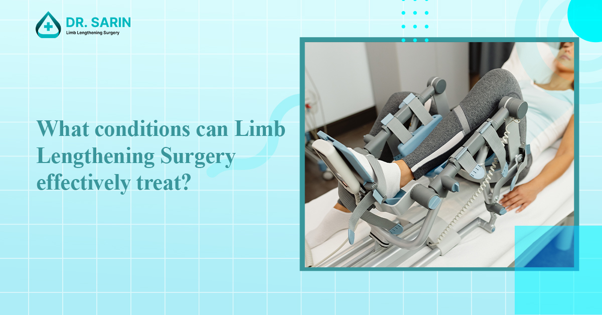 What Conditions Can Limb Lengthening Surgery Effectively Treat?