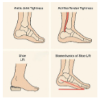 increase calf muscle tightness