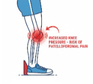 knee pain