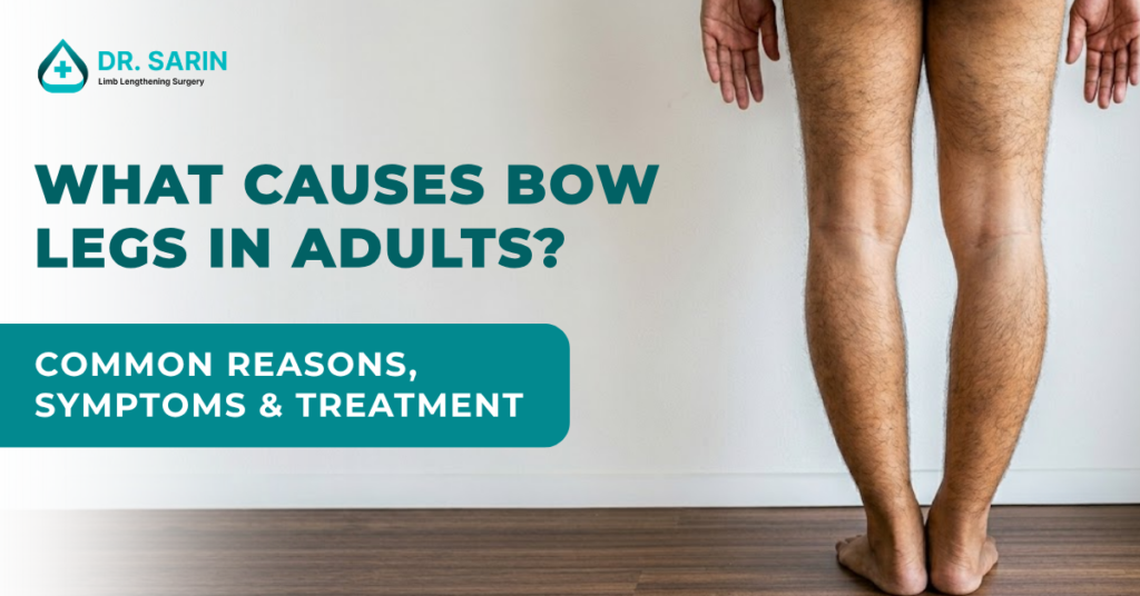 What Causes Bow Legs in Adults