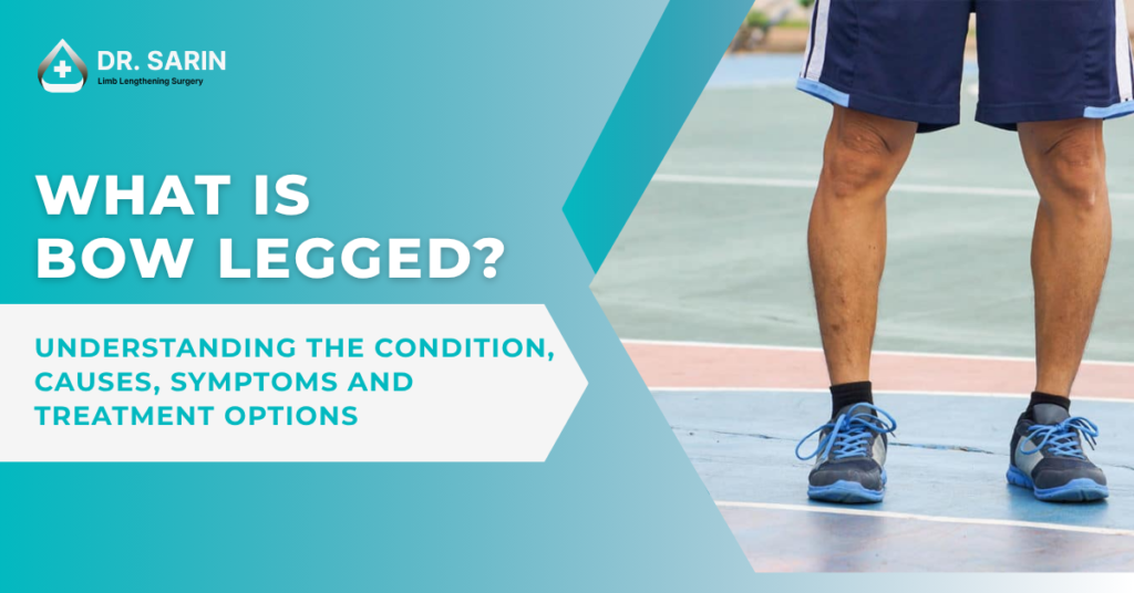 What Is Bow Legged?