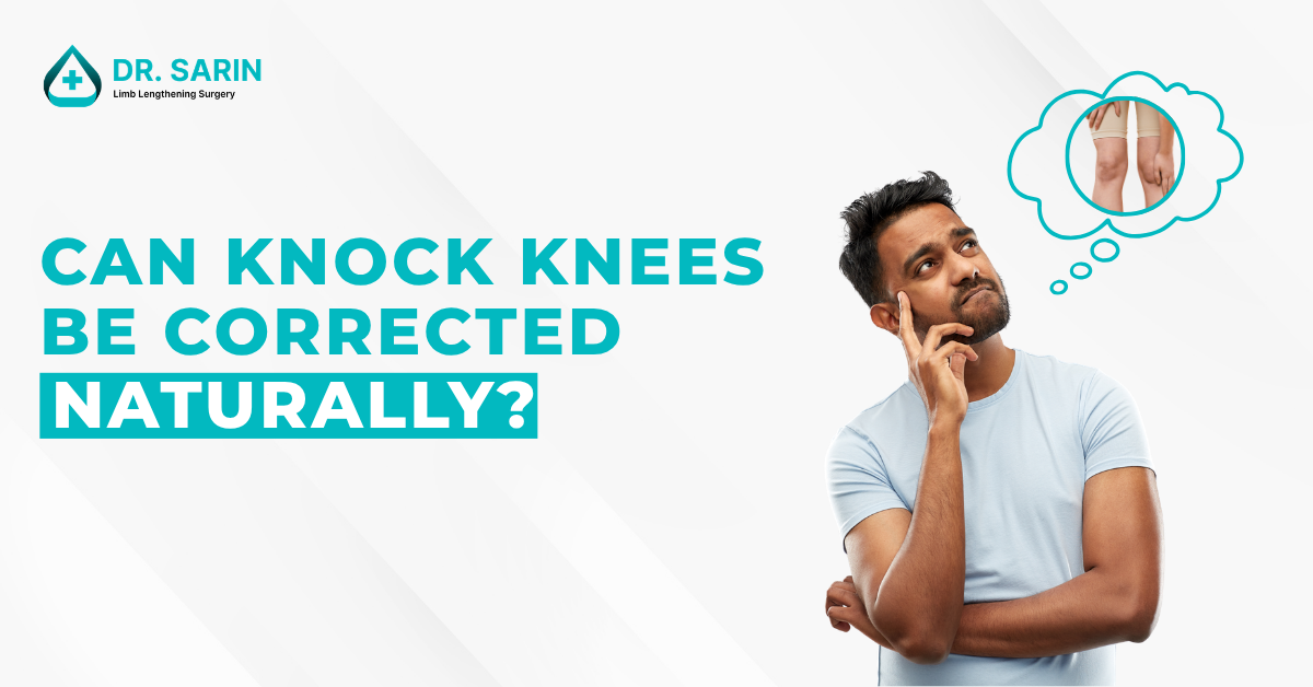 Can knock knees be corrected naturally