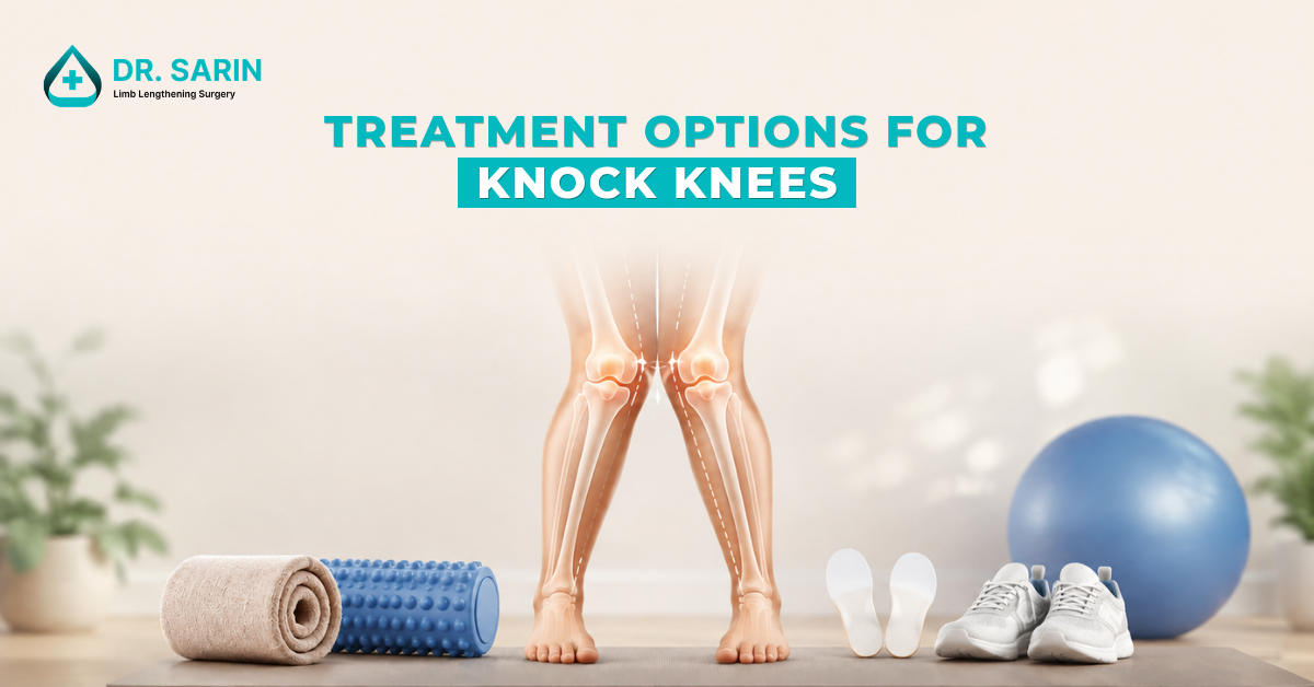 Treatment Options for Knock Knees