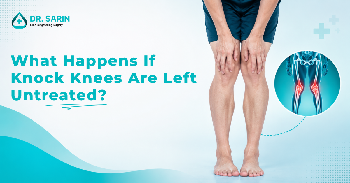 What Happens If Knock Knees Are Left Untreated?