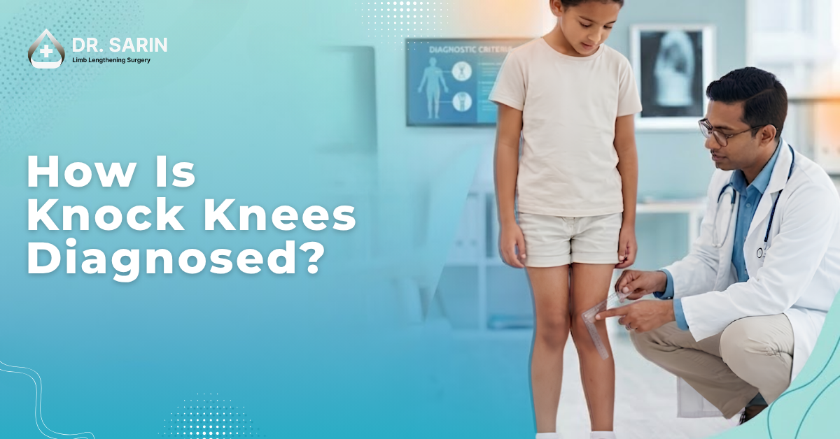How Is Knock Knees Diagnosed?